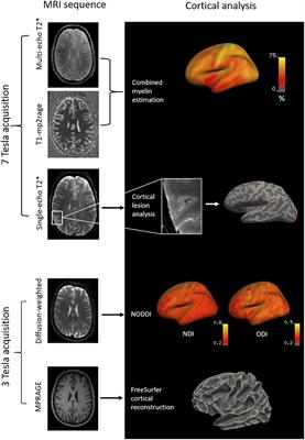 Quantitative 7-Tesla Imaging of Cortical Myelin Changes in Early Multiple Sclerosis